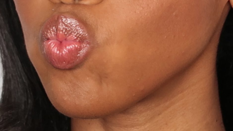 dry lips